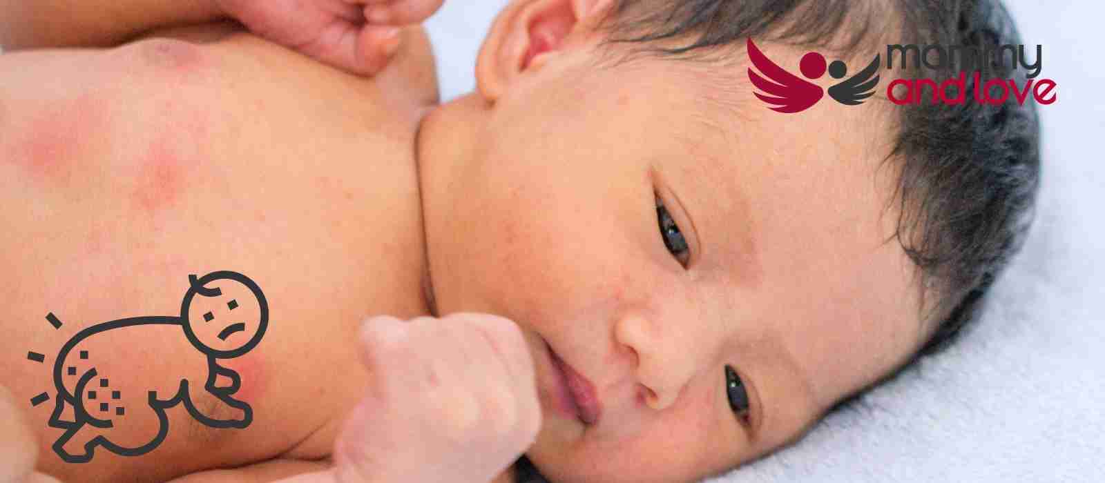 Can a Diaper Rash Spread