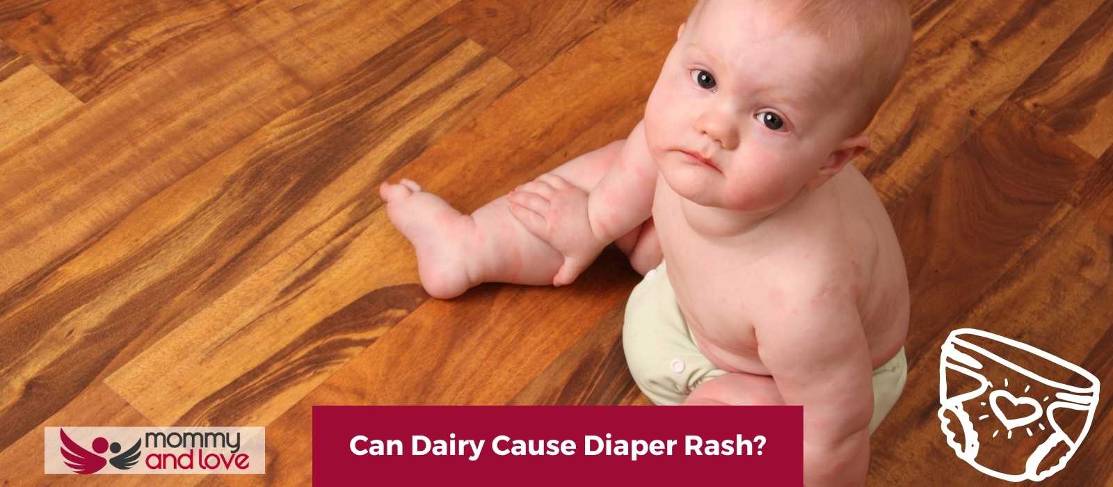 Can Dairy Cause Diaper Rash