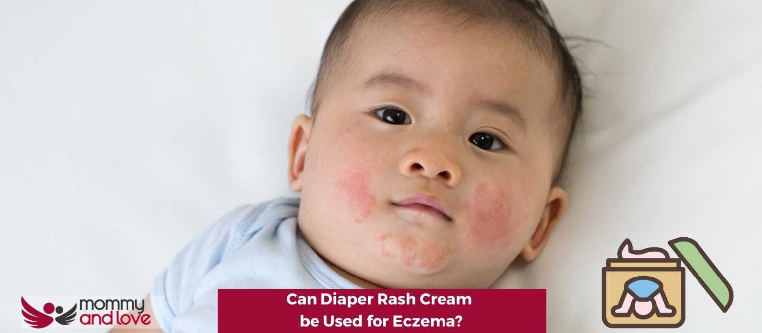 Can Diaper Rash Cream be Used for Eczema? Mommy and Love