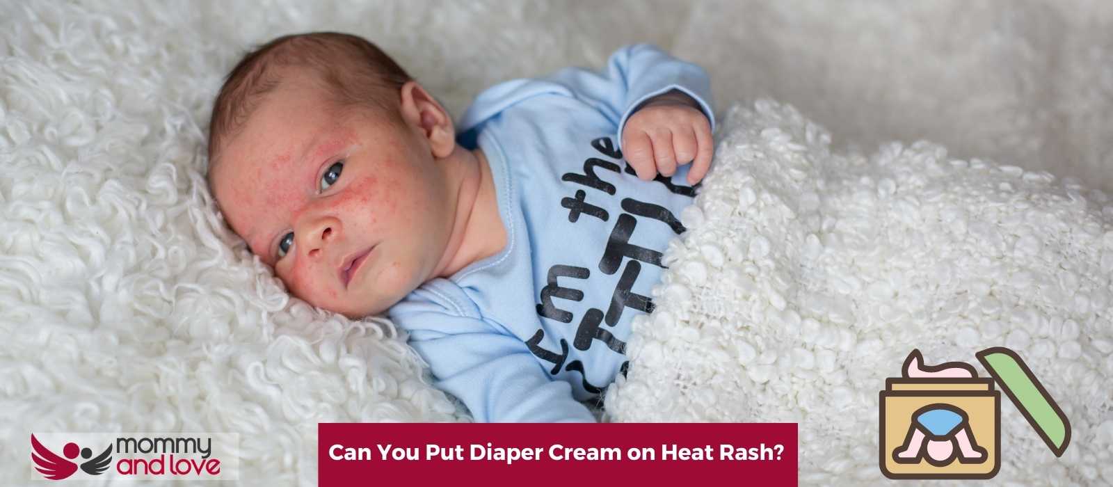 Can You Put Diaper Cream on Heat Rash (1)