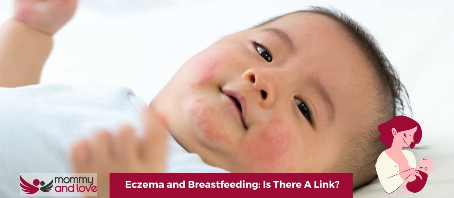 Eczema and Breastfeeding Is There A Link? Mommy and Love