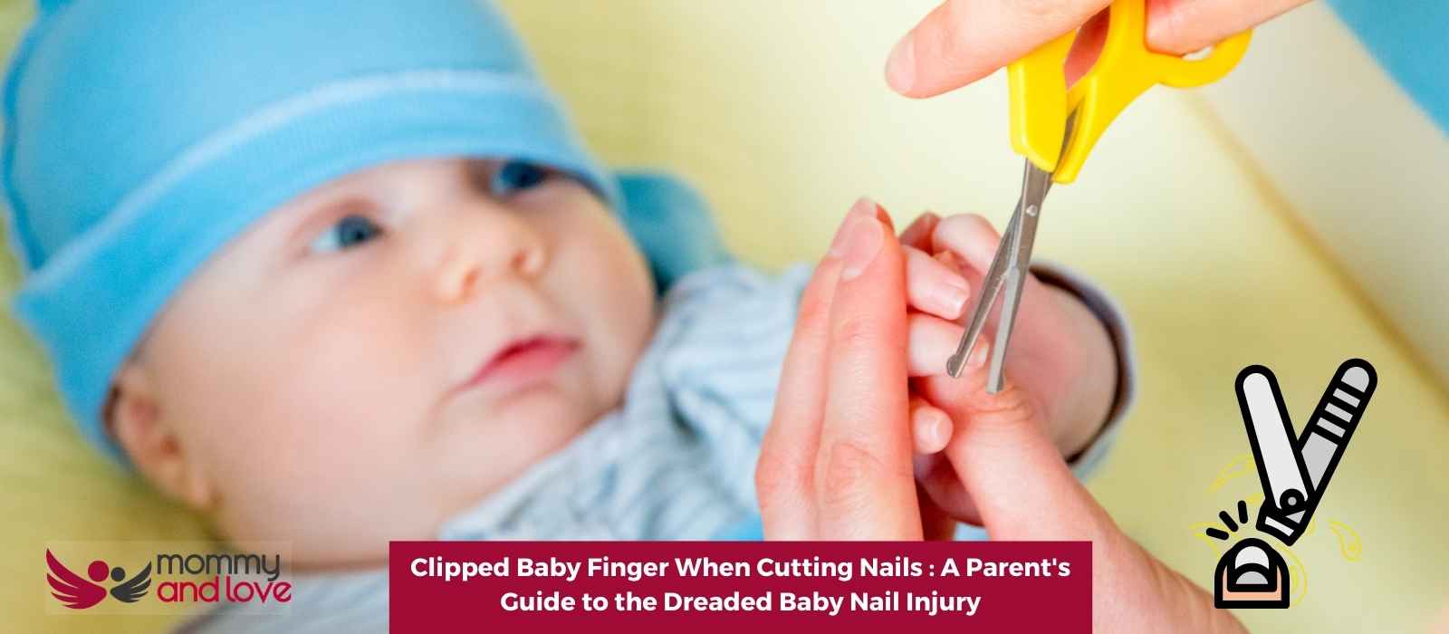 Clipped Baby Finger When Cutting Nails : A Parent's Guide to the Dreaded Baby  Nail Injury - Raising Families Naturally